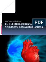 Ekg Uci