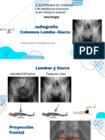 Radiografía Columna Lumbo-Sacra