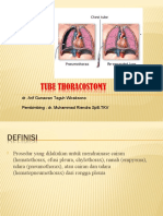 Chest Tube Thoracostomy