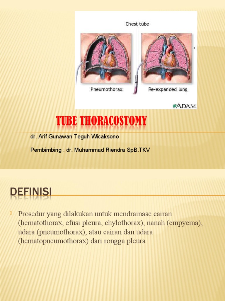 Chest Tube Thoracostomy PDF