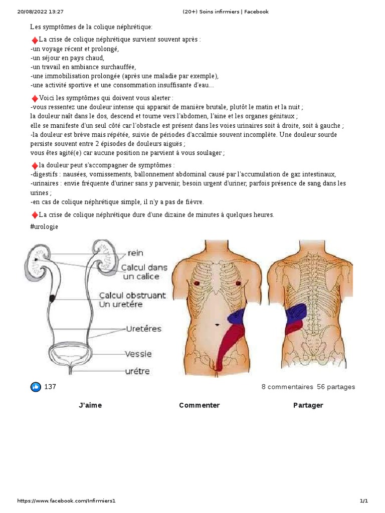 Colique Nephrétique Def , Coliques néphrétiques : quels sont les causes ...