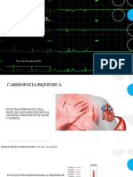 Cambios Isquémicos en El Ekg y Necrosis