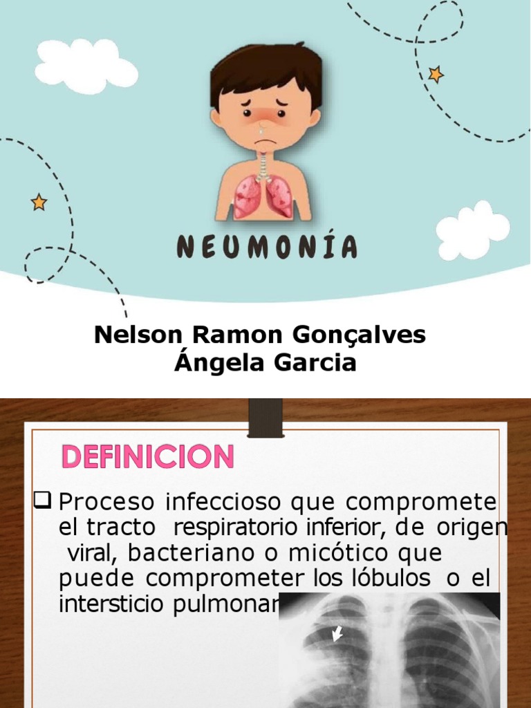 Neumonia Pediatria Pdf Neumonía Epidemiología