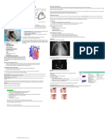 Comunicación Interventricular