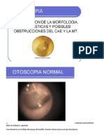 Otoscopia Presentacion
