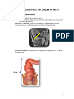 Tema 16. Tratamiento Quirurgico Del Cancer de Recto