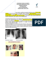 Caso Clinico Lupus Eritematoso Sistemico-Grupo 1