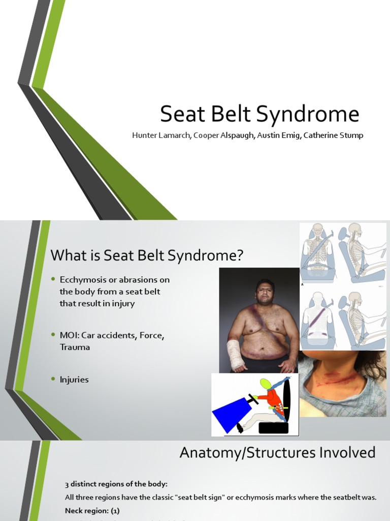 Seat Belt Syndrome PTH 630 Anatomy and Phys PDF Thorax Clinical