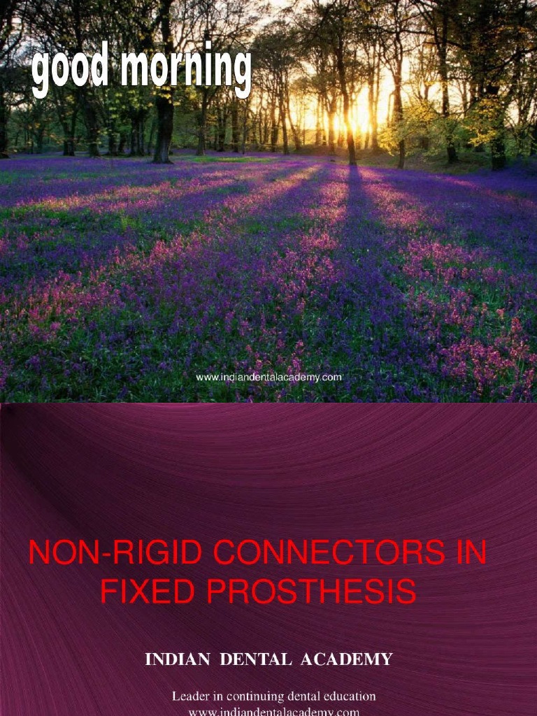 Non Rigid Connectors in FDP PDF