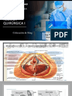 Colocación de Sling Suburetral