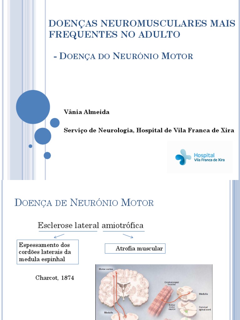 Doença Neuronio Motor Curso Doenças Neuromusculares Sociedade ...