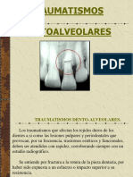 Clasificacindelasfracturasdentoalveolares 101025073721 Phpapp01