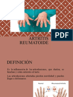 Artritis 