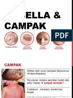 GEJALA DAN PENCEGAHAN CAMPAK DAN RUBELLA