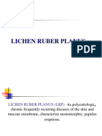 003 - Lichen Ruber Planus