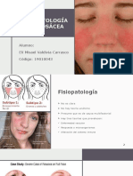 Fisiopatología de La Rosácea