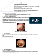 Otitis Media Que Produce Cambios Histológicos Irreversibles Independientemente Del Tiempo Con MT Integra (Secuela O Evolucion de Oma)