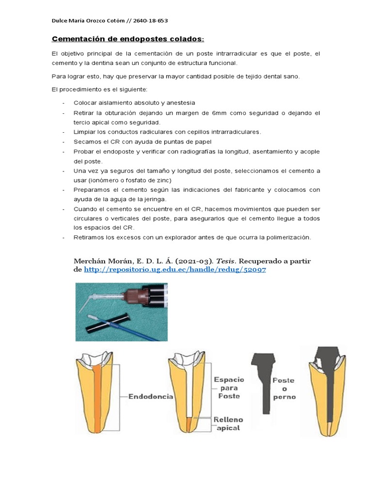 Cementación de Endopostes Colados | PDF