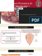 Rotura Prematura de Membranas - Loaiza