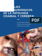 Abordajes Neuroquirurgicos de La