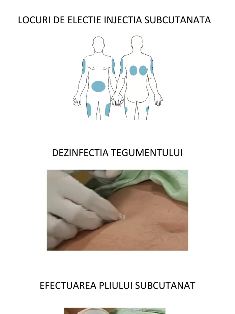 Injectia Intramusculara Locuri De Electie