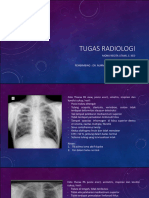 Presentasi Radiologi Rontgen Thorax