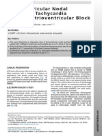 Atrioventricular Nodal Reentrant Tachycardia With 21 Atrioventricular Block.