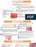 Amigdalitis: causas, síntomas y tratamientos