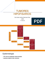 Tumores Hipofisarios