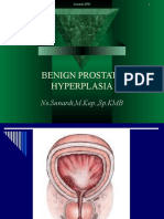 Benign Prostate Hyperplasia