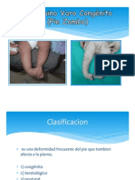 Clasificación y tratamiento del pie zambo
