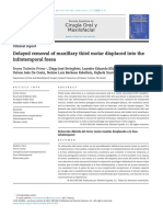 Cirugía Oral y Maxilofacial: Delayed Removal of Maxillary Third Molar Displaced Into The Infratemporal Fossa