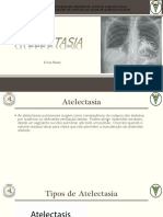 UNIPAC-FASAB: Atelectasia Pulmonar