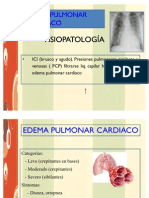 Exposición Edema Final