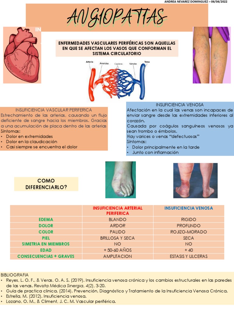Diferencias En Angiopat as Vasculares PDF Trombo Sistema Circulatorio