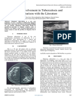 Breast Involvement in Tuberculosis and Comparison With The Literature