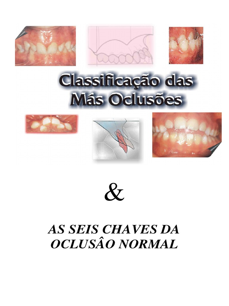 Relação Molar na Oclusão Normal | PDF | Dente | Áreas da odontologia