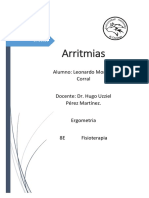 Arritmias 