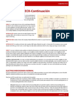 ECK-Continuación: análisis de ondas y complejos en electrocardiograma