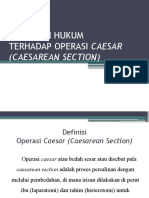 Istinbath Hukum Operasi Caesar