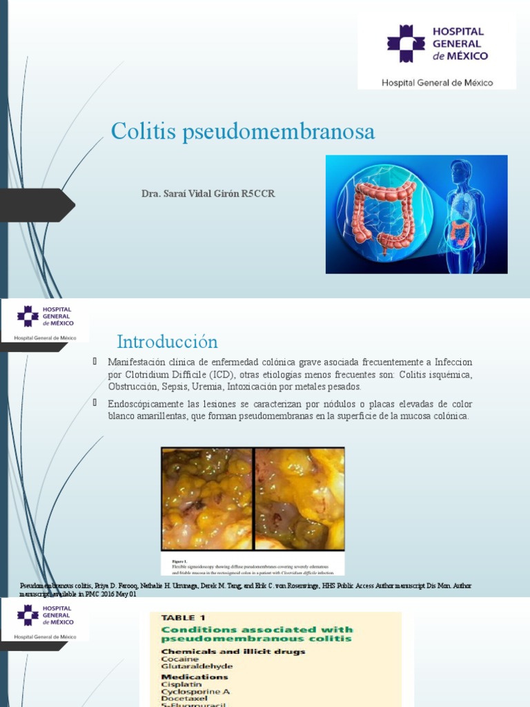 Las múltiples causas de la colitis pseudomembranosa: más allá de ...
