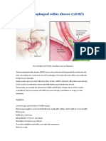 Gastroesophagus Reflux Disease (GERD)