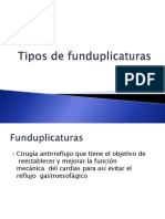 Fundoplicaturas