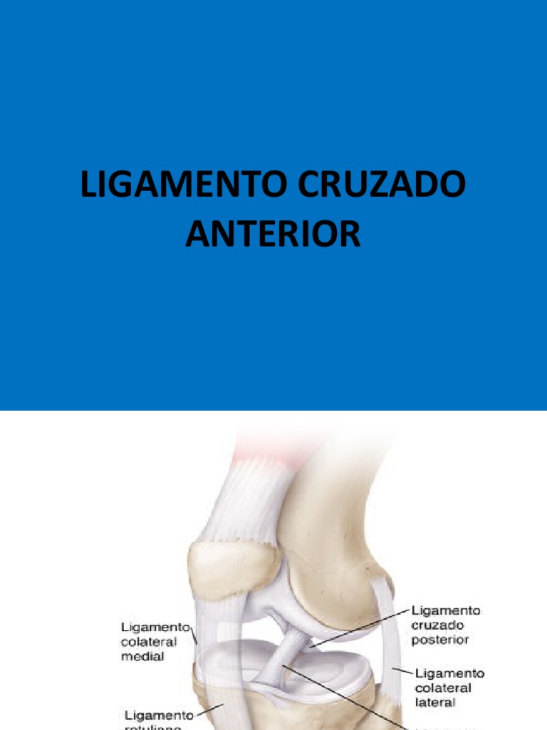 Ilustración Médica 3D De Una Rodilla Dolorida Con Los Ligamentos Cruzados  Anterior Y Posterior Resaltados Stock de ilustración - Ilustración de  ligamento, posterior: 157653447, image size:768x1024