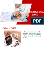 Electromyogram (EMG)