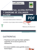 Gastropatias Ulcera Peptica y Sindrome de Zollinger-Ellison