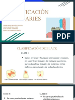 Clasificación de Caries