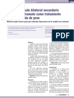 Glaucoma Agudo Bilateral Secundario Al Uso de Topiramato Como Tratamiento para La Perdida de Peso