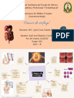 Mapa Mental de Cáncer de Esófago