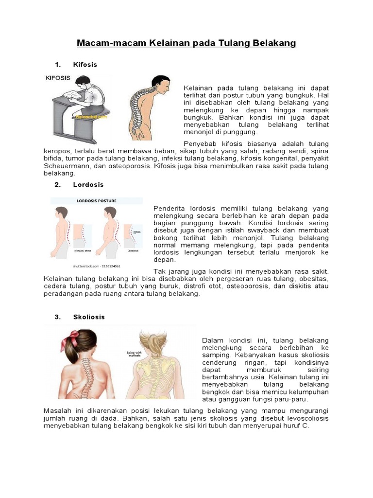 Macam-Macam Kelainan Pada Tulang Belakang | PDF